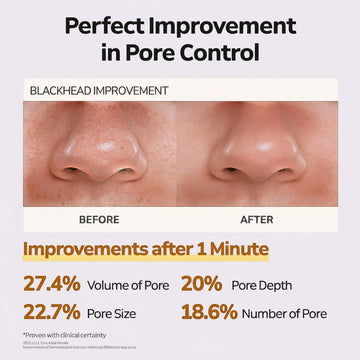 Assemble K - Play .Try .Glow: Before and after comparison of nose pores showing blackhead improvement after using Jojoba Latte Cleanser.