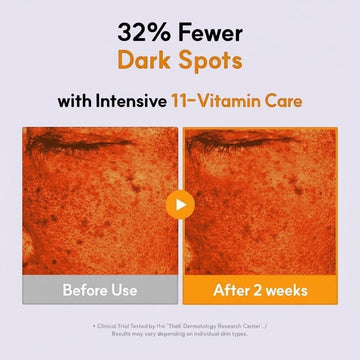 Assemble K - Play .Try .Glow Vita ABCDE Ampoule: Before and after 2 weeks showing reduced dark spots and improved skin.