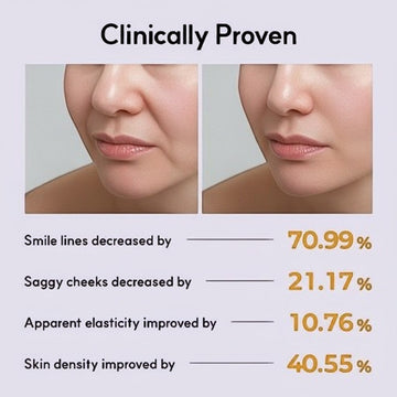 Assemble K - Play .Try .Glow Vita ABCDE Ampoule before and after showing smile line and saggy cheek reduction.
