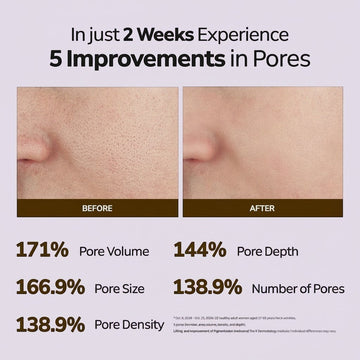 Assemble K - Play .Try .Glow Vita ABCDE Cream before and after pore improvement results. Shows significant reduction in pore volume, size, depth, and density.