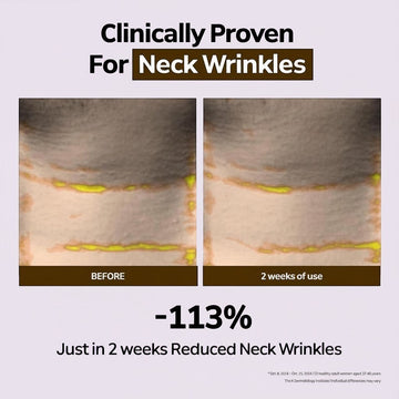 Assemble K - Play .Try .Glow Vita ABCDE Cream clinically proven to reduce neck wrinkles by 113% in 2 weeks.